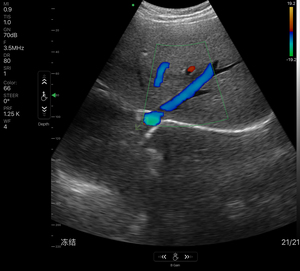 Wireless Medical Ultrasound Probe Portable and Convenient for Diagnostic <strong>Imaging</strong> MSLAA114 - Product Image 6