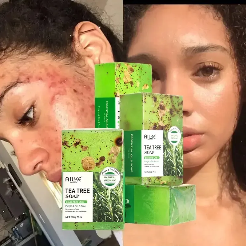 Ailke idratante fatto in casa 200G saponi per la cura della pelle corpo organico per il trattamento dell'acne Bar sapone naturale fatto a mano