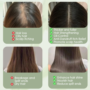 Champú y Jabón Artesanal de Aceite de Coco Orgánico de Proceso en Frío, Anti-Frizz, Suavizante, Nutritivo, Hidratante y Anticaspa con Cúrcuma, 120g - Product Image 5