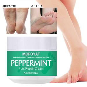 MOPOYAT-Crema reparadora <span class=keywords><strong>de</strong></span> menta para pies, crema para piel áspera, gruesa, seca, agrietada, callos, urea, pies - Product Image 5