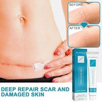 Vente en gros de crème de soin pour la peau pour chirurgie de grossesse 20g