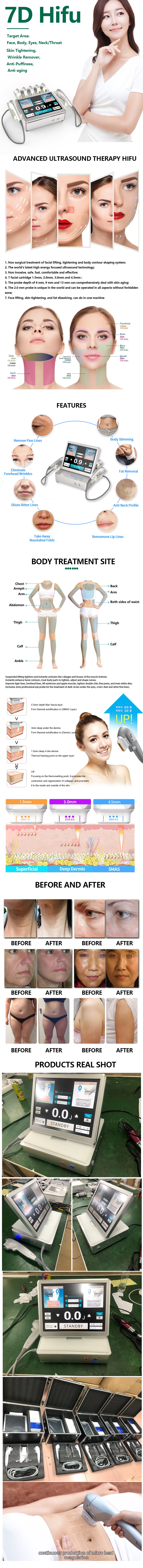 Professional medical korea smas hifu facial lifting machine 6D 7D hifu machine