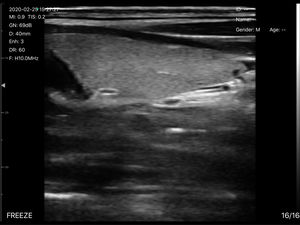 SY-AC51 <span class=keywords><strong>Ultrasound</strong></span> genggam frekuensi Ultra tinggi 20MHz, untuk pencitraan vaskular dan penempatan pengisi - Product Image 5