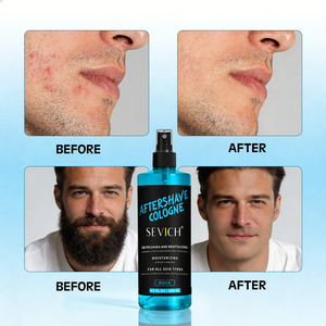 โคโลญจน์หลังโกนหนวด <span class=keywords><strong>SEVICH</strong></span> บำรุงผิวสำหรับผู้ชาย โลชั่นโคโลญจน์หลังโกนหนวด สเปรย์หลังโกนหนวดสูตรเฉพาะ ช่วยให้ความสดชื่นและบรรเทาผิวหน้า - Product Image 6