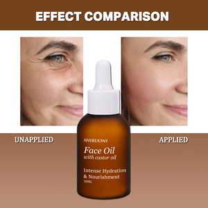 Oem nhãn hiệu riêng mặt dầu thầu dầu dầu mặt điều trị giữ ẩm da cho mặt chăm sóc - Product Image 5