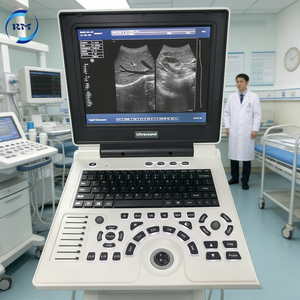 Máquina de Ultrasonido Portátil Médica <span class=keywords><strong>2D</strong></span> en Blanco y Negro, Escáner de Ultrasonido de Diagnóstico para Aplicaciones Hospitalarias/Clínicas - Product Image 5