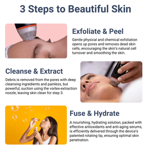 Dispositivo de Burbujas de Oxígeno Hidrofacial <span class=keywords><strong>SVATAR</strong></span> Vortex, Rotación y Succión <span class=keywords><strong>2</strong></span> en 1 para Limpieza de la Piel, Infusión de Suero Vortex, Tonificación de la Piel - Product Image 4