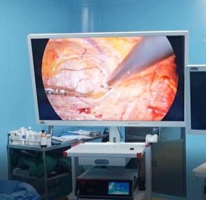 Sistema <span class=keywords><strong>de</strong></span> Cámara Endoscópica Ultra 4K con <span class=keywords><strong>Torre</strong></span> para Cirugía Laparoscópica - Product Image 3