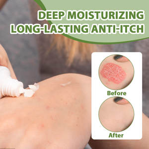 Krim teh eksim, salep antibakteri Dermatitis <span class=keywords><strong>Psoriasis</strong></span>, plester medis pijat Anti gatal kulit - Product Image 5