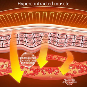 Mesin <span class=keywords><strong>Stimulator</strong></span> Otot EMS Profesional, Mesin Pembentuk Tubuh EMS Zero, Estimulador Muscular Abdominal, Mesin Pembentuk Tubuh - Product Image 4