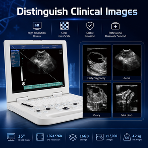 Appareil d'échographie portable avec écran LED HD <span class=keywords><strong>de</strong></span> 15 pouces, scanner <span class=keywords><strong>de</strong></span> diagnostic vétérinaire avec deux ports pour sondes, stockage <span class=keywords><strong>de</strong></span> 16 Go, 4,2 kg - Product Image 4