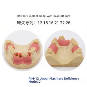 Modelo de práctica de implante dental anatómico con Molde de resina, entrenamiento de ciencia médica, hueso simulado y encías blandas, diente faltante - Product Image 3