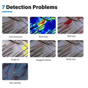 Rilevatore intelligente del cuoio capelluto con Touch Screen per la prevenzione della perdita di capelli e l'analisi del cuoio capelluto policistico-: "capelli tutto in uno - Product Image 6
