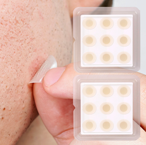 2025 nóng tự hòa tan microneedle mụn mụn các bản vá lỗi cho zits và nhược điểm - Product Image 1