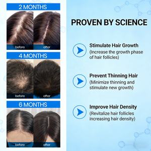 निजी लेबल प्राकृतिक जैविक घक-क्यूई कॉपर पेप्टाइड बाल विकास सीरम एंटी हेयर लॉस रेगेरोथ उपचार हाक-कू बालों का तेल - Product Image 3