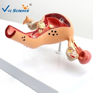 Khoa học y tế mô hình tử cung mô hình giáo dục tử cung giải phẫu người - Product Image 5