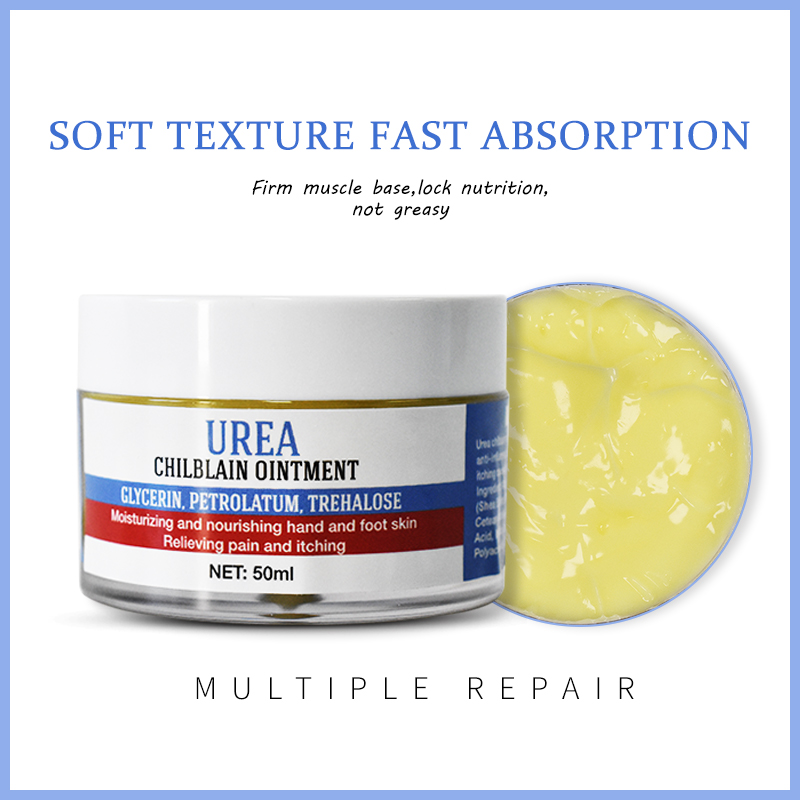 Urea Chilblain Ointment Foot Cream