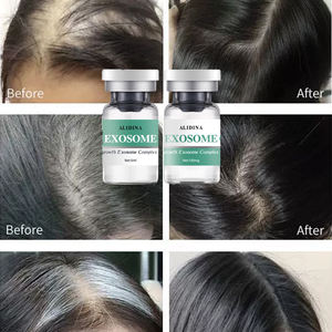 OEM Vente en gros Épaississement des cheveux EXO Sérum EGF Anti-chute Repousse des cheveux Réparation des follicules pileux Nutriment Sérum Exo Some - Product Image 2