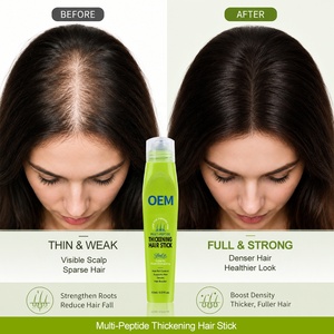เซรั่มคอปเปอร์เปปไทด์สูตรเข้มข้น OEM ODM พร้อมลูกกลิ้งแบบมืออาชีพ ลดการหลุดร่วงของเส้นผม ลดการแตกหัก ปรับแต่งได้ - Product Image 1