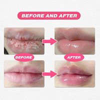 Bálsamo Labial con Sabor a Frutas Nutritivo con Logotipo Personalizado, 10 g, Hidratante de Uso Diario para Labios Secos y Agrietados, para Todo Tipo de Piel