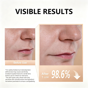 <span class=keywords><strong>Mascarilla</strong></span> Facial <span class=keywords><strong>de</strong></span> Arcilla <span class=keywords><strong>de</strong></span> <span class=keywords><strong>Arroz</strong></span> <span class=keywords><strong>de</strong></span> Marca Privada <span class=keywords><strong>para</strong></span> Piel Grasa con Ácido, Iluminadora, Hidratante, <span class=keywords><strong>para</strong></span> el Acné, Cosméticos Veganos, <span class=keywords><strong>Mascarilla</strong></span> <span class=keywords><strong>de</strong></span> Belleza - Product Image 4