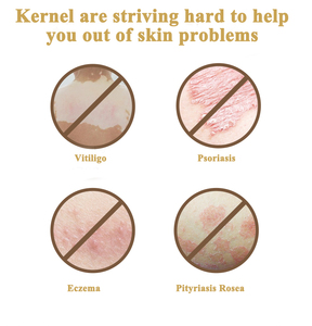 Sistema Portátil de Fototerapia Excimer UVB 308nm para Psoriasis y Vitiligo - Product Image 5