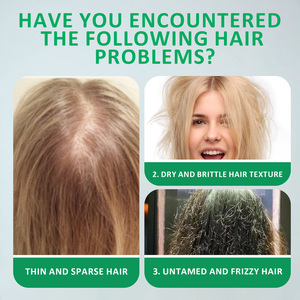 Lanthome hot-bán Hot sản phẩm chăm sóc tóc xà phòng giữ ẩm giữ ẩm hương thảo dầu gội hương thảo và hành tây dầu gội đầu - Product Image 3