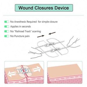 Good Selling Ozone-Disinfected 2.5Cm*1000Cm Medical & Surgical Tape - Product Image 1