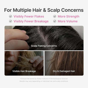 <span class=keywords><strong>Shampoo</strong></span> Coreano al Caviale PDRN Senza Solfati Anti-Caduta e Anti-Danneggiamento, Rinfrescante e <span class=keywords><strong>Volumizzante</strong></span> per la Crescita dei Capelli/Balsamo/Siero per il Cuoio Capelluto - Product Image 6