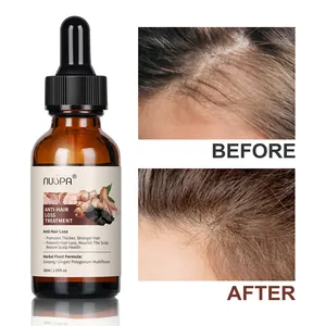 NUSPA Private Label a base di erbe vegano biologico Anti trattamento di perdita di capelli di zenzero olio per la crescita dei capelli calvi - Product Image 4