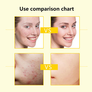 Productos para el cuidado de la piel, blanqueamiento antienvejecimiento, miel, leche, colágeno, arcilla exfoliante, venta al por mayor personalizada - Product Image 3