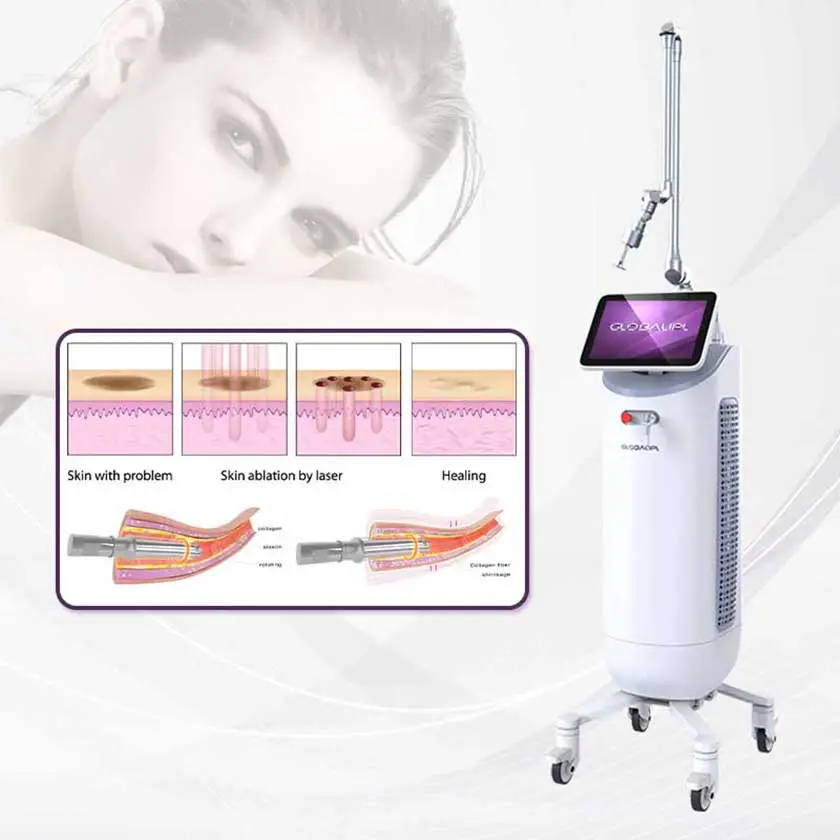 Laser frativo co2, novo design, rejuvenescimento vaginal, remoção de rugas e rejuvenescimento da pele