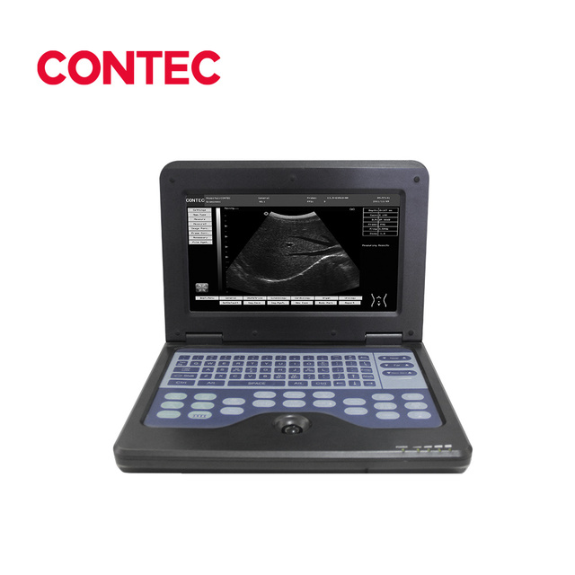 CONTEC CMS600P2 Diagnostic Scanner Medical Diagnostic Equipment