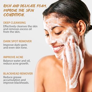 Jabón de Ácido Kójico y Cúrcuma, Eliminador de Manchas Oscuras para Rostro y Cuerpo, Jabón de Baño Aclarante e Hidratante para Eliminar Acné y Puntos Negros - Product Image 6