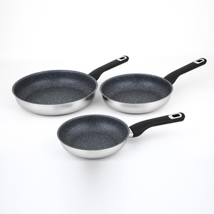 Nouvel ensemble de batterie de cuisine en pierre médicale : poêle à frire, marmite à soupe, casserole, faitout, pot à lait - Product Image 1