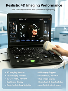 Ecógrafo Doppler Color Portátil Profesional 4D <span class=keywords><strong>5D</strong></span> con Pantalla de 15.6 Pulgadas, Sistema de Diagnóstico Cardíaco, Obstétrico y Ginecológico - Product Image 1