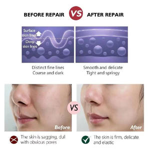 Bola de proteína de seda Soluble en agua con logotipo personalizado ZS, Bola de polvo de Colágeno liofilizado antiarrugas, Bola de Colágeno liofilizado - Product Image 6