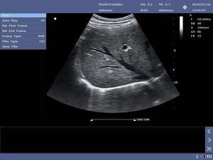 Vind Vergelijkbaar Pictogram Goed Verkopend Diagnostisch Ultrasone Systeem <span class=keywords><strong>2d</strong></span> Ultrasone Beeldvorming Kleur Doppler Machine - Product Image 6