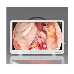 27Inch/32Inch Giá Đặc Biệt FHD HD 1080P Hình Ảnh Nội Soi Máy Ảnh Y Tế Xách Tay Máy Ảnh Nội Soi Hệ Thống Cho Ent Tiết niệu - Product Image 2
