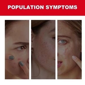 Hàn Quốc ban đầu vô hình Hydrocolloid mụn vá nhãn hiệu riêng nhanh chóng và dễ dàng hình bầu dục Hydrocolloid vá Stickers với logo - Product Image 4