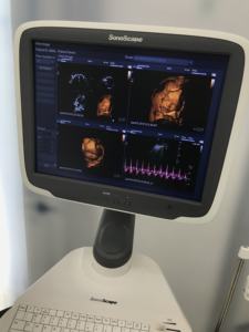 <span class=keywords><strong>SonoScape</strong></span> S12 rolley, цветной доплеровский ультразвуковой аппарат 3D 4D, ультразвук - Product Image 5