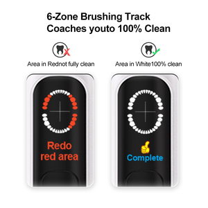 <span class=keywords><strong>Cepillo</strong></span> de <span class=keywords><strong>Dientes</strong></span> Eléctrico Inteligente con Sensor de Presión, Vibración, Recargable, Resistente al <span class=keywords><strong>Agua</strong></span> IPX7, con Logotipo Personalizado y Empaque para Uso en Hoteles y Viajes - Product Image 3