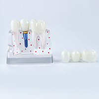 Modèle dentaire transparent pour implant oral humain à usage médical avec couronne et pont, à des fins d'étude dentaire, CE/ISO