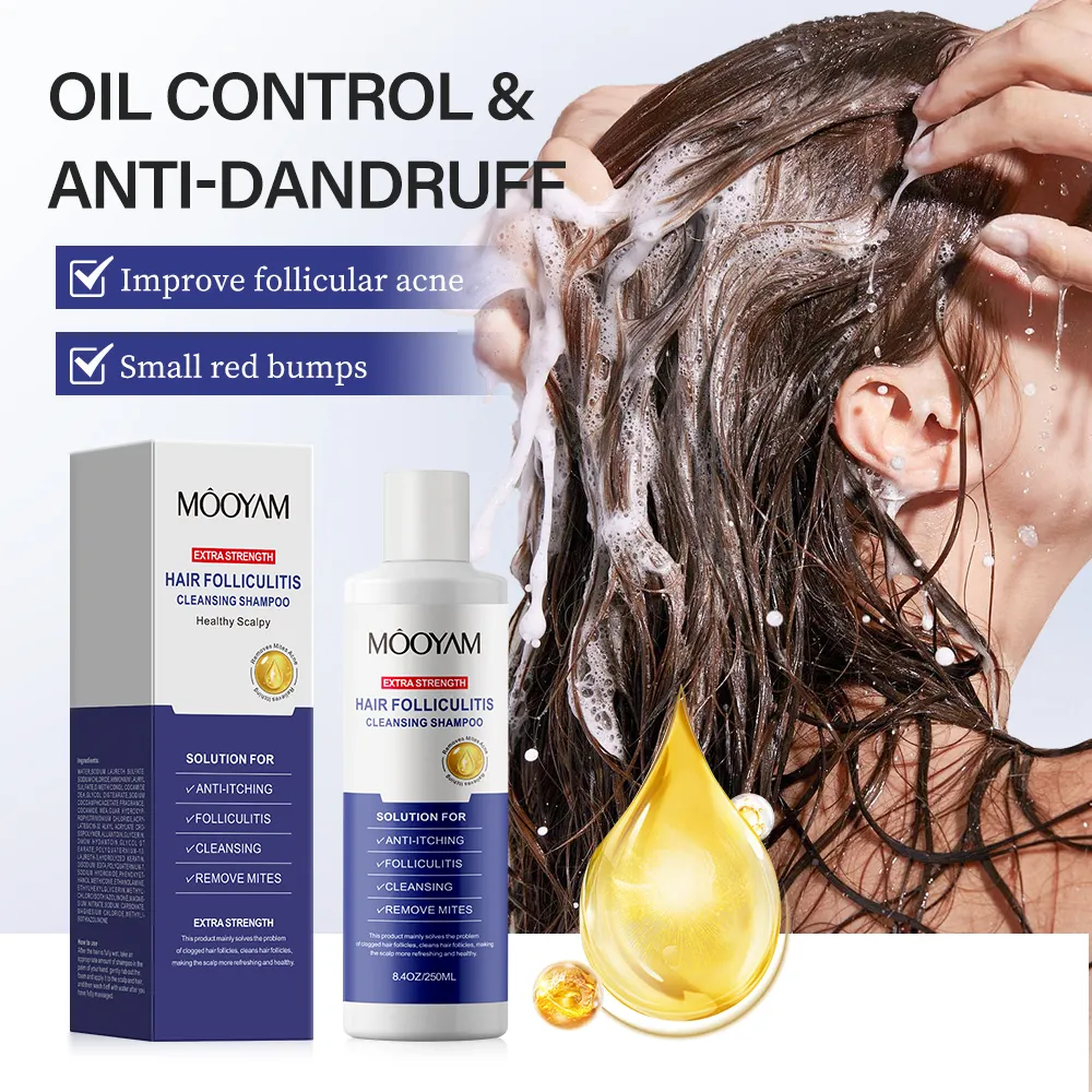 Reinigt Haarfollikel entfernt Milben Haltet Essuchen Shampoo Anti-Essuchen Anti-Akne 250 ml MOOYAM Haarfolliculitis Reinigungs-Shampoo