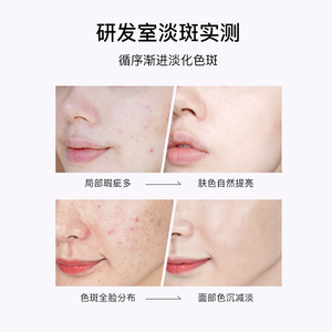 Esencia Blanqueadora Beline Beauty 2ml 30pcs, Suero para Eliminar Manchas y Aclarar la Piel del Rostro - Product Image 3