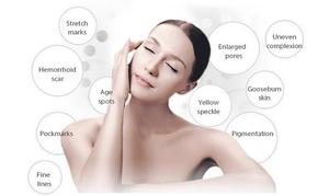 Máquina Estética Portátil 3 en 1 Ultra US con 3 Sondas 1mhz/3mhz para Rostro y Cuerpo - Product Image 4
