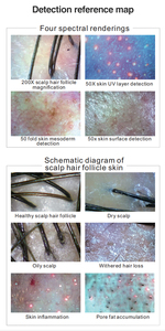 Détection d'inflammation Détecter l'humidité de la peau Machine d'analyse des cheveux WIFI Détection HD Analyse de l'acné sans fil Pigmentation - Product Image 5