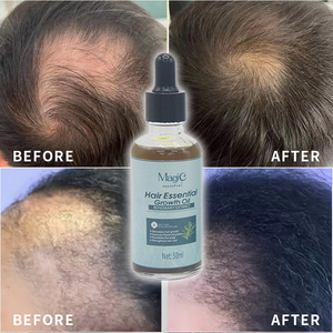 ヘアケア製品エッセンシャルオイル50mlヘアケア - Product Image 4