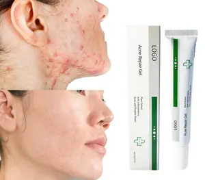 Gel de traitement des taches d'acné biologique, crème réparatrice des cicatrices pour le visage, sans huile, Maximum