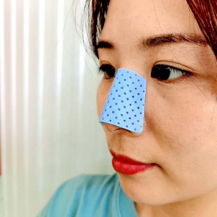 High Quality Multi Colors Medical Thermoplastic External Nasal Splints with factory price